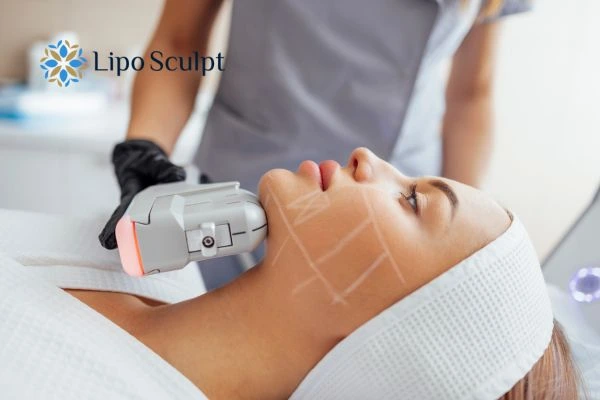 HIFU vs Botulinum Toxin: Understanding the Differences 1 HIFU vs Botox Cannock What is the best option for you?