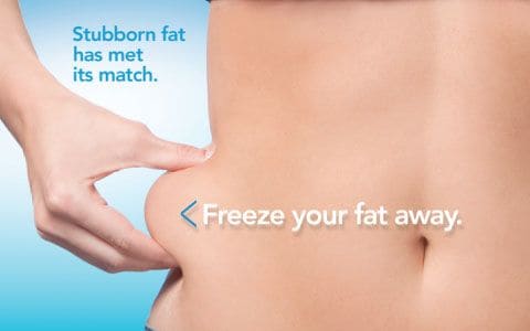 Hips treatment Cannock From Lipo Sculpt