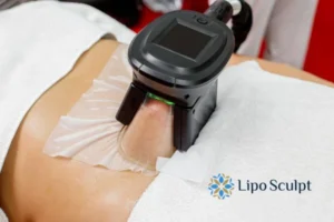 Cryolipolysis Helping You Getting that Perfect Summer Body 3 Cryolipolysis Cannock can give you the best summer body - contact us today!