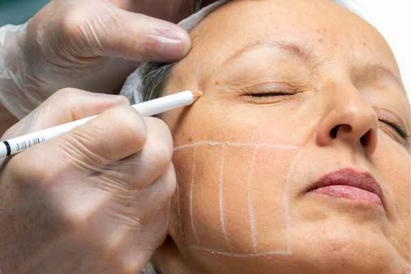 CryoPen: 5 Skin Concerns It May Be Used to Treat 4 What should you ask before having CryoPen treatment Cannock?