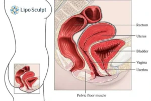 Treatment For A Leaky Bladder 2 How EM Chair treatment Cannock can help Leaky bladder issues. Read more now!