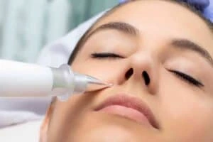Best Actinic Keratoses Removal 3 Actinic keratoses Cannock solutions - book in today!