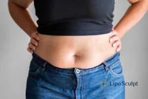 Bidding Farewell to Muffin Tops with Aqualyx Fat Injections 2 Do you wish you could reduce your muffin top Cannock With Aqualy fat dissolving injections you can!